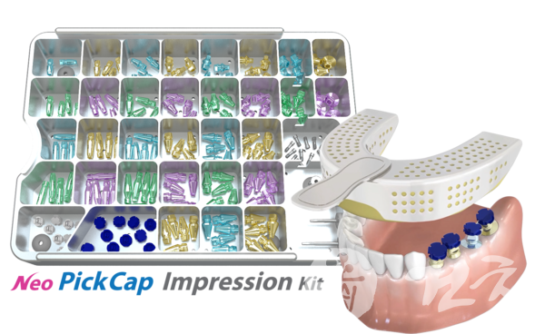 3D 임프레션과 PickCap Coping Kit